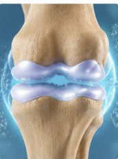 2. Restore Cushioning & Joint Fluid Balance